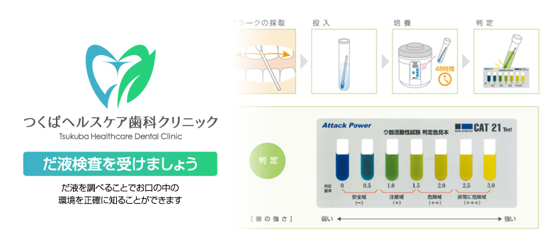 だ液検査を受けましょう・つくばヘルスケア歯科クリニック・予防歯科診療の詳細